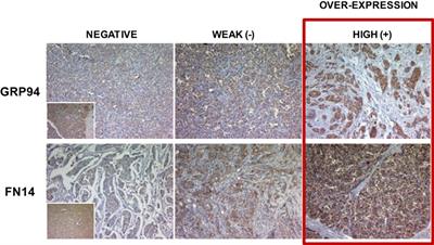 Predictive and Prognostic Brain Metastases Assessment in Luminal Breast Cancer Patients: FN14 and GRP94 from Diagnosis to Prophylaxis